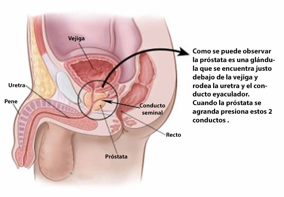 muștar și prostatita amestec împotriva prostatitei recenzii